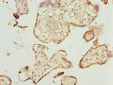 Immunohistochemistry of paraffin-embedded human placenta tissue using TMEM143 Antibody at dilution of 1:100Rabbit anti-Human TMEM143 Polyclonal Antibody