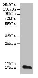 Western blot  | All lanes: TMEM14A antibody at 0.8µg/ml + PC-3 whole cell lysate  | Secondary  | Goat polyclonal to rabbit IgG at 1/10000 dilution  | Predicted band size: 11 kDa  | Observed band size: 11 kDaRabbit anti-Human TMEM14A Polyclonal Antibody