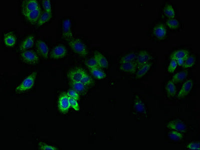 Immunofluorescent analysis of HepG2 cells using TMEM14B Antibody at dilution of 1:100 and Alexa Fluor 488-congugated AffiniPure Goat Anti-Rabbit IgG(H+L)Rabbit anti-Human TMEM14B Polyclonal Antibody