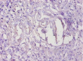 Immunohistochemistry of paraffin-embedded human kidney tissue using TMEM14B Antibody at dilution of 1:100Rabbit anti-Human TMEM14B Polyclonal Antibody