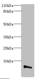 Western blot | All lanes: Transmembrane protein 14B antibody at 2μg/ml + K562 whole cell lysate | Secondary | Goat polyclonal to rabbit IgG at 1/10000 dilution | Predicted band size: 13, 9 kDa | Observed band size: 13 kDaRabbit anti-Human TMEM14B Polyclonal Antibody