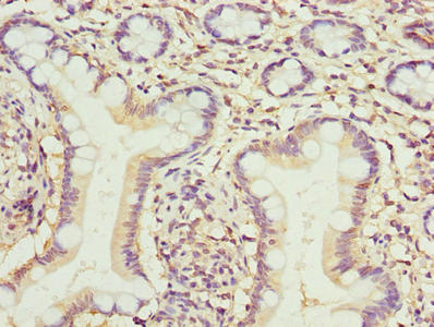 Immunohistochemistry of paraffin-embedded human small intestine tissue using TMEM154 Antibody at dilution of 1:100Rabbit anti-Human TMEM154 Polyclonal Antibody