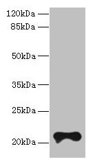 Western blot  | All lanes: TMEM154 antibody at 6µg/ml + MCF-7 whole cell lysate  | Secondary  | Goat polyclonal to rabbit IgG at 1/10000 dilution  | Predicted band size: 21 kDa  | Observed band size: 21 kDaRabbit anti-Human TMEM154 Polyclonal Antibody