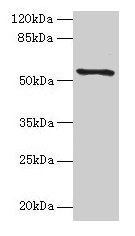 Western blot  | All lanes: TMEM161A antibody at 1µg/ml + PC-3 whole cell lysate  | Secondary  | Goat polyclonal to rabbit IgG at 1/10000 dilution  | Predicted band size: 54, 42 kDa  | Observed band size: 54 kDaRabbit anti-Human TMEM161A Polyclonal Antibody