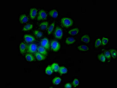 Immunofluorescent analysis of A549 cells using TMEM161B Antibody at dilution of 1:100 and Alexa Fluor 488-congugated AffiniPure Goat Anti-Rabbit IgG(H+L)Rabbit anti-Human TMEM161B Polyclonal Antibody