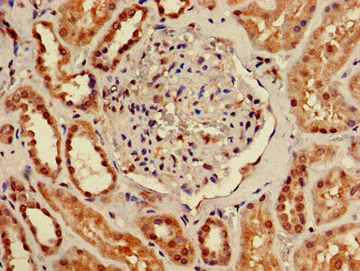 Immunohistochemistry of paraffin-embedded human kidney tissue using the antibody at dilution of 1:100Rabbit anti-Human TMEM161B Polyclonal Antibody