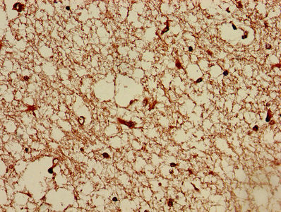 Immunohistochemistry of paraffin-embedded human brain tissue using TMEM161B Antibody at dilution of 1:100Rabbit anti-Human TMEM161B Polyclonal Antibody