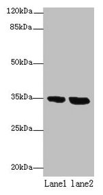 Western blot  | All lanes: TMEM165 antibody at 8µg/ml  | Lane 1: Jurkat whole cell lysate  | Lane 2: Hela whole cell lysate  | Secondary  | Goat polyclonal to rabbit IgG at 1/10000 dilution  | Predicted band size: 35, 29 kDa  | Observed band size: 35 kDaRabbit anti-Human TMEM165 Polyclonal Antibody