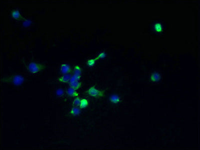 Immunofluorescent analysis of 293T cells using TMEM174 Antibody at dilution of 1:100 and Alexa Fluor 488-congugated AffiniPure Goat Anti-Rabbit IgG(H+L)Rabbit anti-Human TMEM174 Polyclonal Antibody