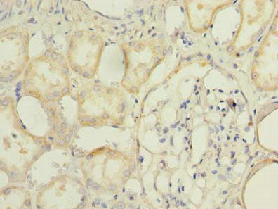 Immunohistochemistry of paraffin-embedded human kidney tissue using TMEM174 Antibody at dilution of 1:100Rabbit anti-Human TMEM174 Polyclonal Antibody