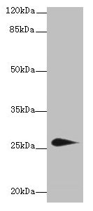 Western blot  | All lanes: TMEM174 antibody at 0.8µg/ml + Mouse kidney tissue  | Secondary  | Goat polyclonal to rabbit IgG at 1/10000 dilution  | Predicted band size: 27, 24 kDa  | Observed band size: 27 kDaRabbit anti-Human TMEM174 Polyclonal Antibody