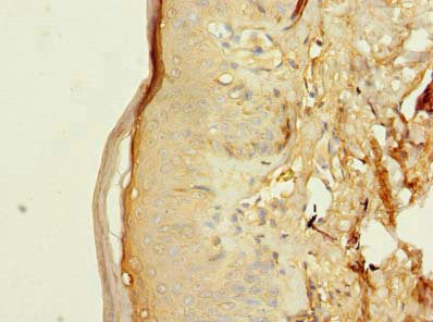 Immunohistochemistry of paraffin-embedded human skin tissue using TMEM176B Antibody at dilution of 1:100Rabbit anti-Human TMEM176B Polyclonal Antibody