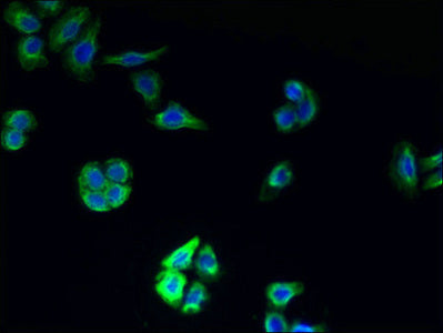 Immunofluorescent analysis of PC-3 cells using TMEM177 Antibody at dilution of 1:100 and Alexa Fluor 488-congugated AffiniPure Goat Anti-Rabbit IgG(H+L)Rabbit anti-Human TMEM177 Polyclonal Antibody