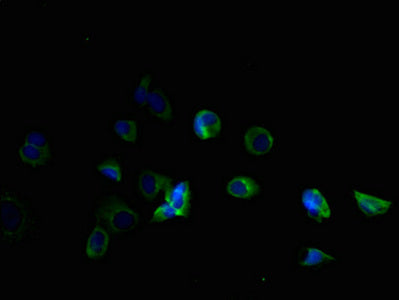 Immunofluorescent analysis of MCF-7 cells using the antibody at dilution of 1:100 and Alexa Fluor 488-congugated AffiniPure Goat Anti-Rabbit IgG(H+L)Rabbit anti-Human TMEM184B Polyclonal Antibody