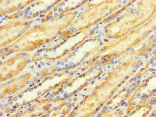 Immunohistochemistry of paraffin-embedded human kidney tissue using TMEM184B Antibody at dilution of 1:100Rabbit anti-Human TMEM184B Polyclonal Antibody