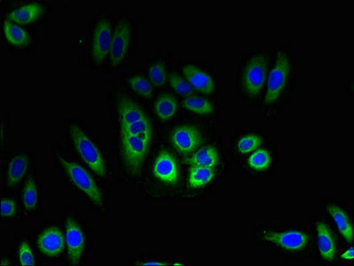 Immunofluorescent analysis of HepG2 cells using TMEM184C Antibody at dilution of 1:100 and Alexa Fluor 488-congugated AffiniPure Goat Anti-Rabbit IgG(H+L)Rabbit anti-Human TMEM184C Polyclonal Antibody