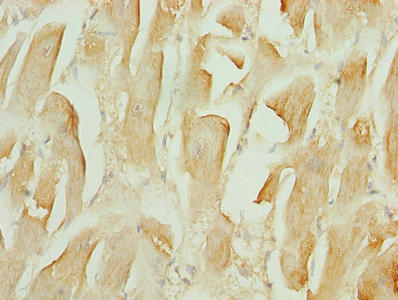 Immunohistochemistry of paraffin-embedded human heart tissue using the antibody at dilution of 1:100Rabbit anti-Human TMEM184C Polyclonal Antibody