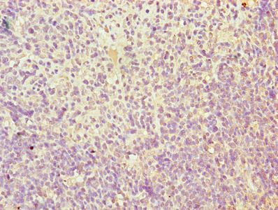 Immunohistochemistry of paraffin-embedded human thymus tissue using TMEM184C Antibody at dilution of 1:100Rabbit anti-Human TMEM184C Polyclonal Antibody