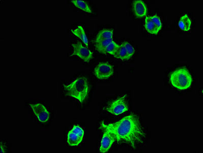 Immunofluorescent analysis of MCF-7 cells using TMEM186 Antibody at dilution of 1:100 and Alexa Fluor 488-congugated AffiniPure Goat Anti-Rabbit IgG(H+L)Rabbit anti-Human TMEM186 Polyclonal Antibody