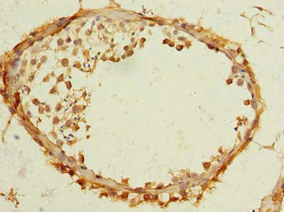 Immunohistochemistry of paraffin-embedded human testis tissue using the antibody at dilution of 1:100Rabbit anti-Human TMEM186 Polyclonal Antibody