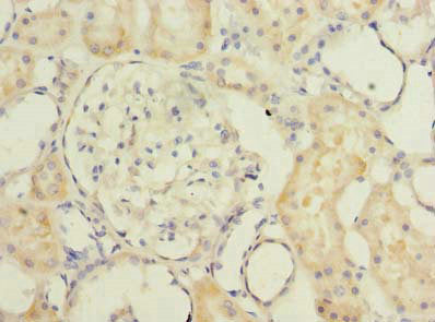 Immunohistochemistry of paraffin-embedded human kidney tissue using TMEM186 Antibody at dilution of 1:100Rabbit anti-Human TMEM186 Polyclonal Antibody
