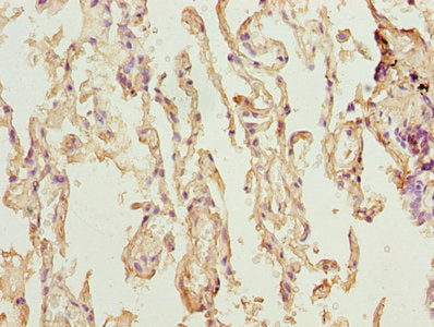 Immunohistochemistry of paraffin-embedded human lung tissue using TMEM19 Antibody at dilution of 1:100Rabbit anti-Human TMEM19 Polyclonal Antibody