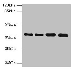 Western blot  | All lanes: TMEM19 antibody at 1µg/ml  | Lane 1: MCF-7 whole cell lysate  | Lane 2: U251 whole cell lysate  | Lane 3: Mouse stomach tissue  | Lane 4: A549 whole cell lysate  | Secondary  | Goat polyclonal to rabbit IgG at 1/10000 dilution  | Predicted band size: 37, 33 kDa  | Observed band size: 37 kDaRabbit anti-Human TMEM19 Polyclonal Antibody