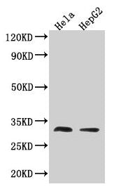 Western Blot  | Positive WB detected in: Hela whole cell lysate, HepG2 whole cell lysate  | All lanes: TMEM192 antibody at 3.2µg/ml  | Secondary  | Goat polyclonal to rabbit IgG at 1/50000 dilution  | Predicted band size: 31 kDa  | Observed band size: 31 kDaRabbit anti-Human TMEM192 Polyclonal Antibody
