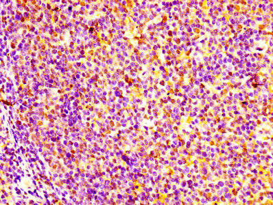 Immunohistochemistry of paraffin-embedded human tonsil tissue using GM2A Antibody at dilution of 1:100Rabbit anti-Human GM2A Polyclonal Antibody