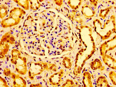Immunohistochemistry of paraffin-embedded human kidney tissue using GM2A Antibody at dilution of 1:100Rabbit anti-Human GM2A Polyclonal Antibody