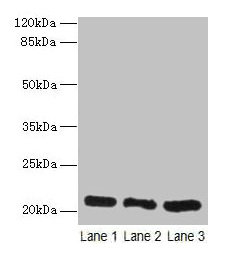 Western blot  | All lanes: GM2A antibody at 10µg/ml  | Lane 1: Rat liver tissue  | Lane 2: Mouse stomach tissue  | Lane 3: Mouse small intestine tissue  | Secondary  | Goat polyclonal to rabbit IgG at 1/10000 dilution  | Predicted band size: 21 kDa  | Observed band size: 21 kDaRabbit anti-Human GM2A Polyclonal Antibody