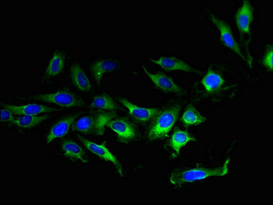 Immunofluorescent analysis of Hela cells using the antibody at dilution of 1:100 and Alexa Fluor 488-congugated AffiniPure Goat Anti-Rabbit IgG(H+L)Rabbit anti-Human TMEM207 Polyclonal Antibody