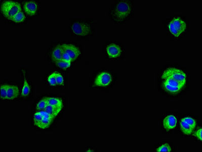 Immunofluorescent analysis of MCF-7 cells using TMEM222 Antibody at dilution of 1:100 and Alexa Fluor 488-congugated AffiniPure Goat Anti-Rabbit IgG(H+L)Rabbit anti-Human TMEM222 Polyclonal Antibody