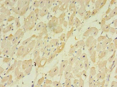 Immunohistochemistry of paraffin-embedded human heart tissue using TMEM222 Antibody at dilution of 1:100Rabbit anti-Human TMEM222 Polyclonal Antibody