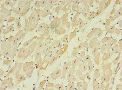 Immunohistochemistry of paraffin-embedded human heart tissue using TMEM222 Antibody at dilution of 1:100Rabbit anti-Human TMEM222 Polyclonal Antibody