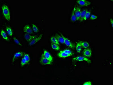 Immunofluorescent analysis of HepG2 cells using TMEM31 Antibody at dilution of 1:100 and Alexa Fluor 488-congugated AffiniPure Goat Anti-Rabbit IgG(H+L)Rabbit anti-Human TMEM31 Polyclonal Antibody