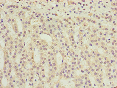 Immunohistochemistry of paraffin-embedded human adrenal gland tissue using the antibody at dilution of 1:100Rabbit anti-Human TMEM31 Polyclonal Antibody