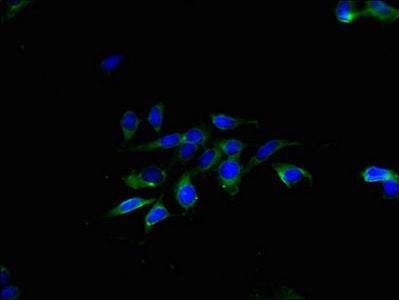 Immunofluorescent analysis of Hela cells using the antibody at dilution of 1:100 and Alexa Fluor 488-congugated AffiniPure Goat Anti-Rabbit IgG(H+L)Rabbit anti-Human TMEM40 Polyclonal Antibody