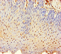 Immunohistochemistry of paraffin-embedded human tonsil tissue using TMEM40 Antibody at dilution of 1:100Rabbit anti-Human TMEM40 Polyclonal Antibody