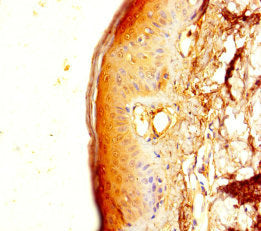 Immunohistochemistry of paraffin-embedded human skin tissue using TMEM40 Antibody at dilution of 1:100Rabbit anti-Human TMEM40 Polyclonal Antibody
