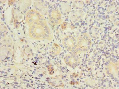 Immunohistochemistry of paraffin-embedded human pancreatic tissue using TMEM41A Antibody at dilution of 1:100Rabbit anti-Human TMEM41A Polyclonal Antibody