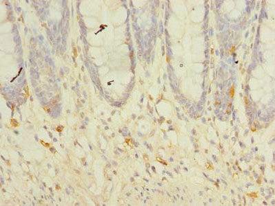 Immunohistochemistry of paraffin-embedded human colon tissue using TMEM41A Antibody at dilution of 1:100Rabbit anti-Human TMEM41A Polyclonal Antibody