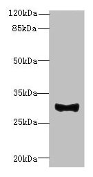 Western blot  | All lanes: TMEM41A antibody at 0.5µg/ml + Mouse liver tissue  | Secondary  | Goat polyclonal to rabbit IgG at 1/10000 dilution  | Predicted band size: 30 kDa  | Observed band size: 30 kDaRabbit anti-Human TMEM41A Polyclonal Antibody