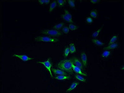 Immunofluorescent analysis of HepG2 cells using TMEM44 Antibody at dilution of 1:100 and Alexa Fluor 488-congugated AffiniPure Goat Anti-Rabbit IgG(H+L)Rabbit anti-Human TMEM44 Polyclonal Antibody