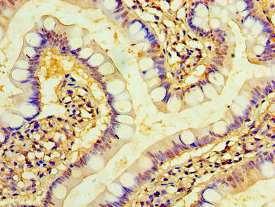 Immunohistochemistry of paraffin-embedded human small intestine tissue using the antibody at dilution of 1:100Rabbit anti-Human TMEM44 Polyclonal Antibody