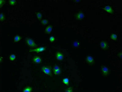 Immunofluorescent analysis of A2780 cells using TMEM45A Antibody at dilution of 1:100 and Alexa Fluor 488-congugated AffiniPure Goat Anti-Rabbit IgG(H+L)Rabbit anti-Human TMEM45A Polyclonal Antibody