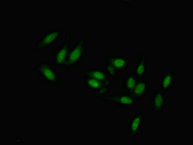 Immunofluorescent analysis of Hela cells using TMEM47 Antibody at dilution of 1:100 and Alexa Fluor 488-congugated AffiniPure Goat Anti-Rabbit IgG(H+L)Rabbit anti-Human TMEM47 Polyclonal Antibody