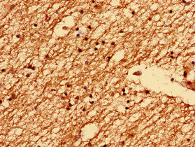 Immunohistochemistry analysis of human brain tissue using TMEM47 Antibody at dilution of 1:100Rabbit anti-Human TMEM47 Polyclonal Antibody