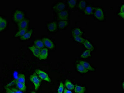 Immunofluorescent analysis of LO2 cells using PIP4P2 Antibody at dilution of 1:100 and Alexa Fluor 488-congugated AffiniPure Goat Anti-Rabbit IgG(H+L)Rabbit anti-Human PIP4P2 Polyclonal Antibody
