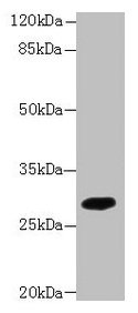 Western blot  | All lanes: PIP4P2 antibody at 5µg/ml + Mouse liver tissue  | Secondary  | Goat polyclonal to rabbit IgG at 1/10000 dilution  | Predicted band size: 29 kDa  | Observed band size: 29 kDaRabbit anti-Human PIP4P2 Polyclonal Antibody